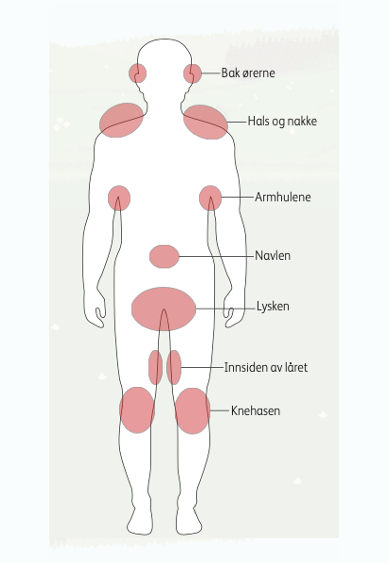 Illustrasjon av områder på kroppen det er vanlig å få flåttbitt og som bør sjekkes etter man har vært på tur. 